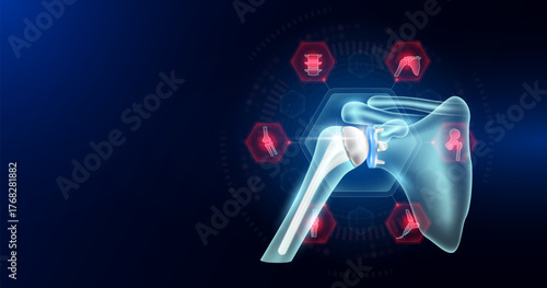 Shoulder replacement surrounded by arthritis icons. Artificial joint surgery, prosthetic implant integrated into the bone. Orthopedic technology medical. Empty space for text. Vector EPS10.