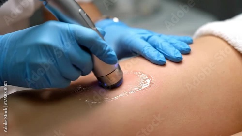 Professional Leg Treatment Using Modern Equipment in Beauty Salon as Body Shaping Procedure with Specialist Using Blue Gloves Applying Gel for Patient Comfort and Effectiveness