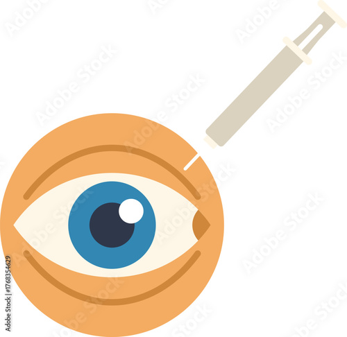 Syringe injecting medicine into a human eyeball, depicting a medical procedure for vision correction or eye disease treatment