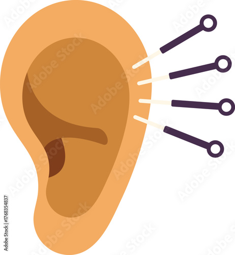 Auriculotherapy treatment stimulating acupuncture points with needles on human ear