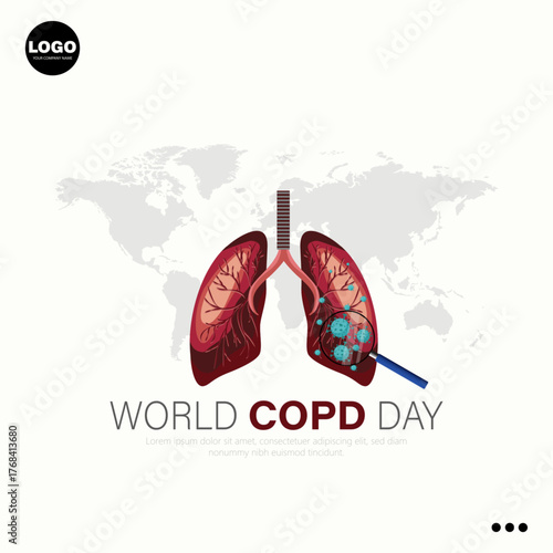 World COPD Day is a global event held annually on the third Wednesday of November.