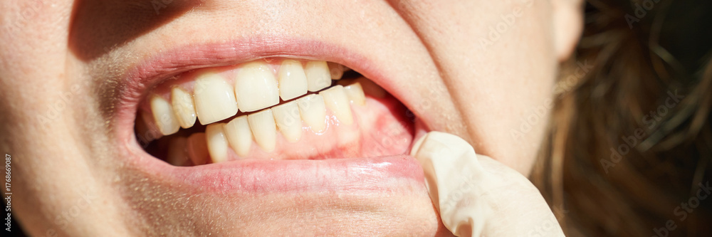 Fototapeta premium Close-up of female adult caucasian mouth with healthy teeth and dentists gloved hand examining gums.
