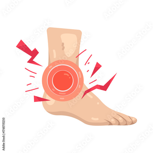 Illustration of Painful Ankle Injury