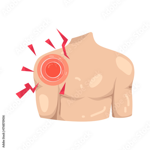 Illustration of Shoulder Pain