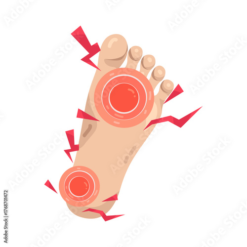Illustration of Foot with Pain Points