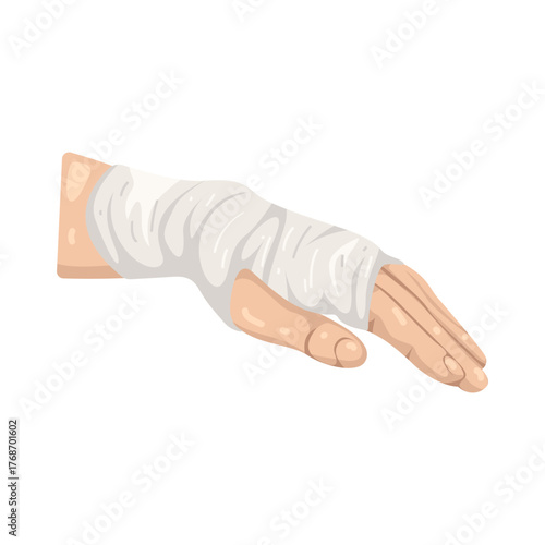 Illustration of Arm in Bandage