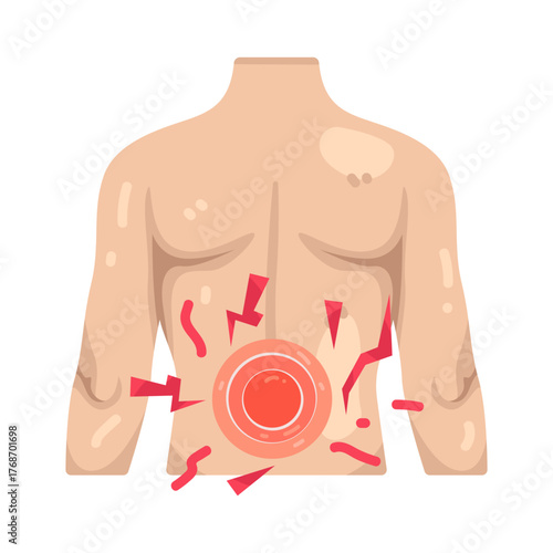 Illustration of Lower Back Pain on Human Body