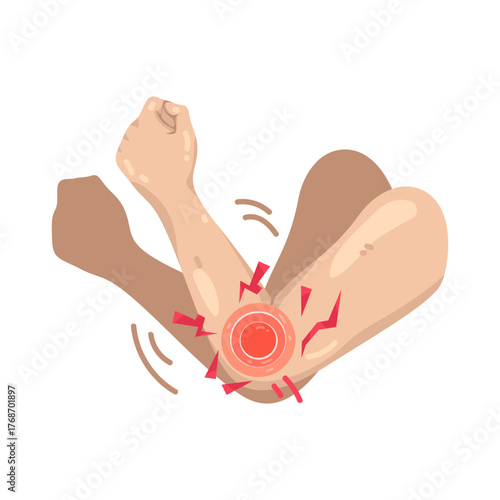 Illustration of Elbow Pain