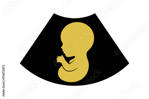 Ultrasound baby scan pregnancy fetus medical image art