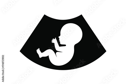 Ultrasound baby scan pregnancy fetal development image