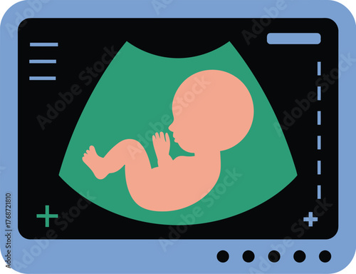 Ultrasound baby scan pregnancy diagnostic technology