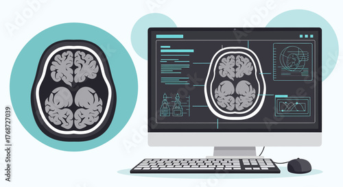 Human Brain Scan On A Computer Screen, Medical Diagnosis Concept