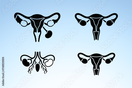 Silhouettes of female reproductive system illustrating ovaries, uterus, and fallopian tubes on blue