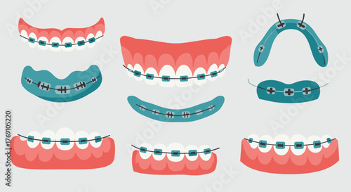 Orthodontic braces set on transparent background for dental care and treatment