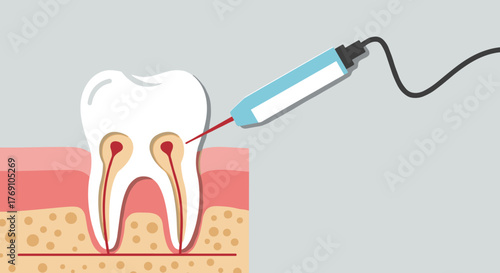 Dental laser treatment concept with tooth and gum anatomy
