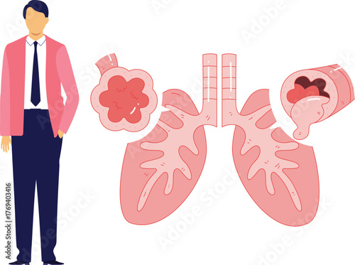 The doctor research on bronchitis problem.