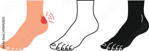 Foot pain achilles tendonitis heel pain plantar fasciitis anatomy