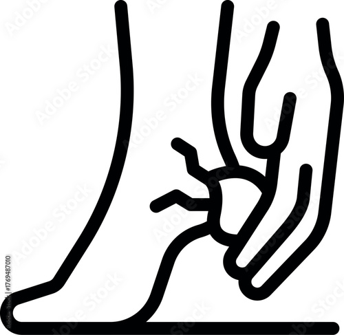 Medical professional carefully removing a tick from a patient's ankle, emphasizing the importance of prompt removal to prevent lyme disease