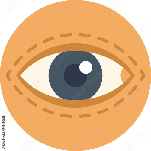 This illustration shows the procedure of blepharoplasty, a surgery to remove excess skin from the eyelids