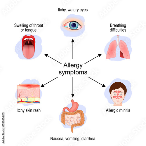 Allergy symptoms