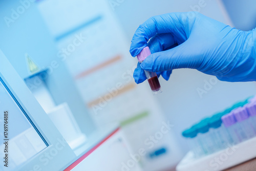 Tableau sur toile Gloved hand handling blood sample in veterinary clinic laboratory setting