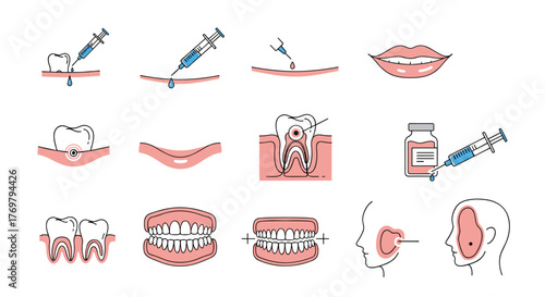 Set of simple thin line icons depicting dental and medical procedures including gingival injection, lip augmentation, root canal treatment, and earlobe treatment, suitable for web, books, cards, and