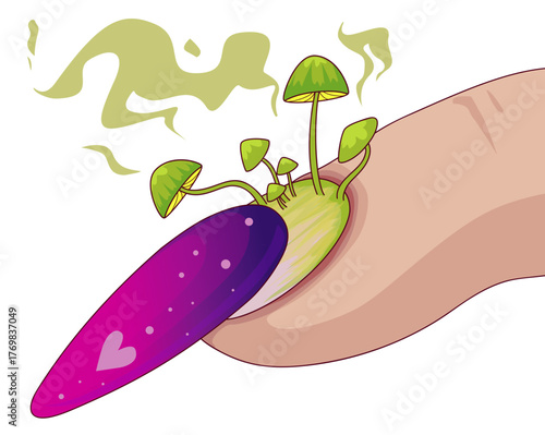 Nail plate disease. Nail plate fungus. healthcare illustration. Vector illustration.