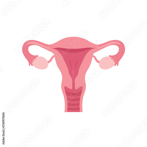Anatomical illustration of the female reproductive system, including uterus, fallopian tubes, and ovaries.