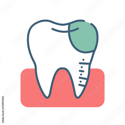 Stylized illustration of a human tooth with a green dental restoration and root details within the gum line.