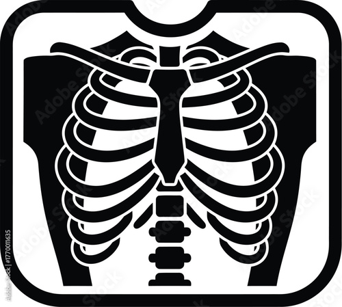 Chest x ray radiology medical scan healthcare diagnostic imaging body