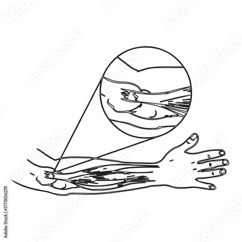 Arm Muscles Illustration