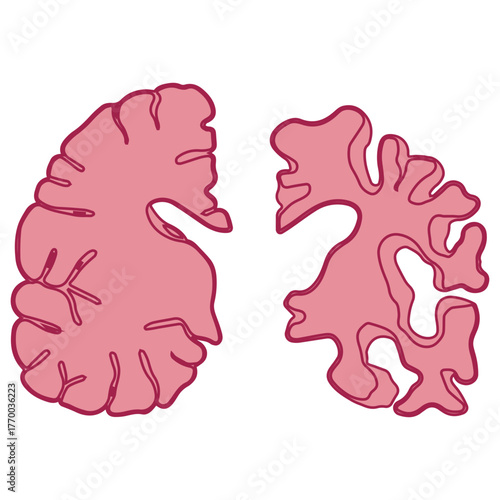 Brain Atrophy Comparison