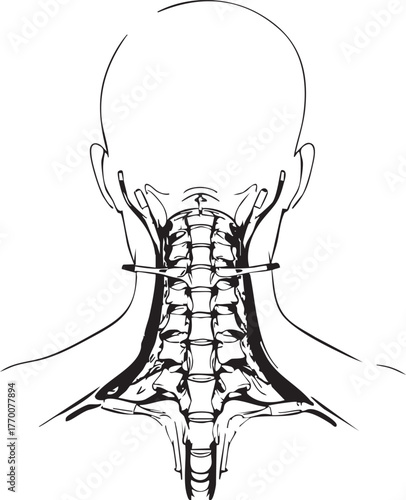 Posterior cervical spine anatomy with muscles and vertebrae, detailed medical vector for education and clinical use