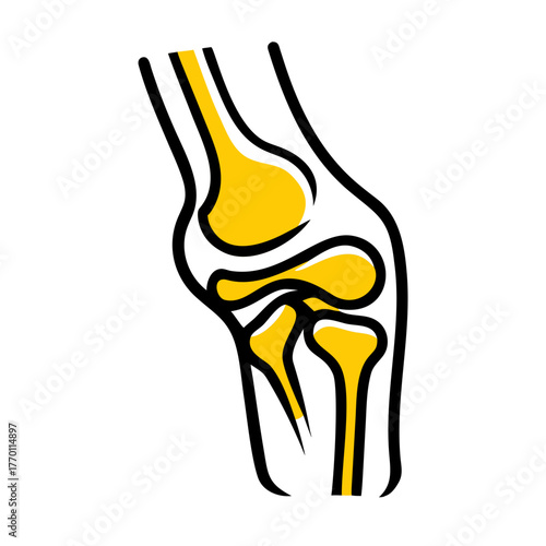 3D vector illustration showing detailed arthritis in human knee joint, highlighting inflammation and cartilage damage, realistic medical anatomy concept