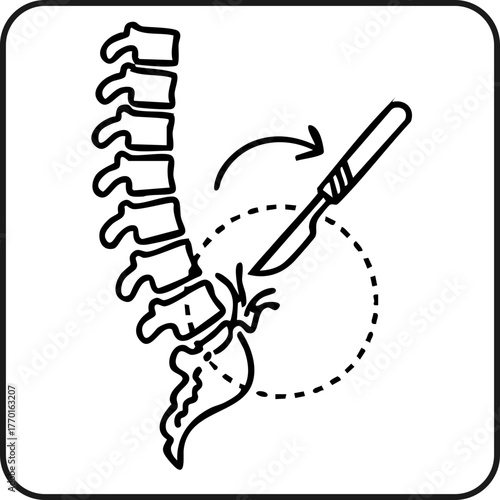 Spinal surgery