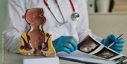 Foto Doctor rectal examination and transrectal ultrasound
