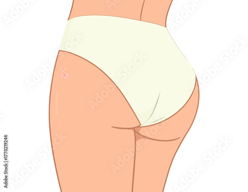 Illustration of a person's rear view, showcasing the buttocks and upper thighs, wearing white underwear.