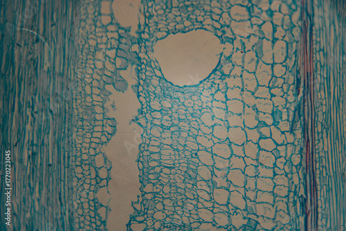 Tableau sur toile Close-up microscope image of stained parenchyma cells of plant tissue, showing large, rounded cells with distinct blue cell walls