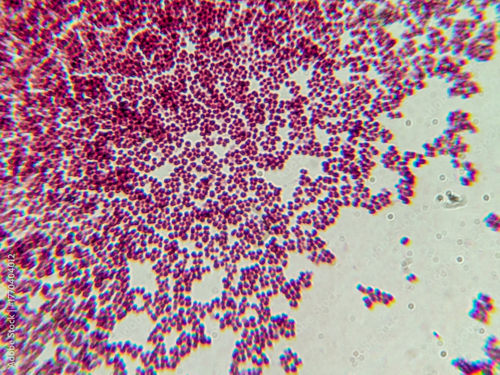 Fototapeta premium Microscopic View of Purple Cocci Bacteria Clustered in Grapelike Formation