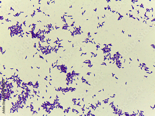 Microscopic Field of Dense, Clumped Bacilli (Rod-Shaped Bacteria) After Gram Stainin