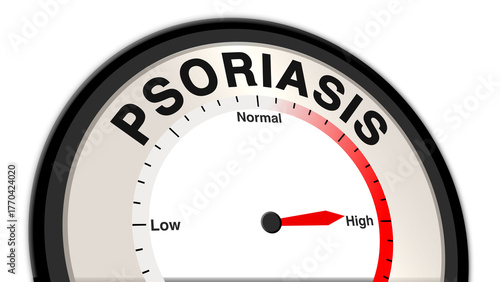Photos Psoriasis at a severe level depicted on a barometer or tachometer, symbolizing w