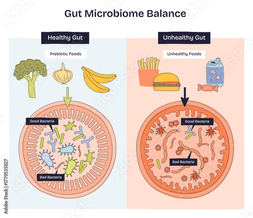 Gut microbiome balance shown as healthy vs unhealthy intestines, good and bad bacteria shift with prebiotic foods and junk food, key objects, intestine, bacteria, foods. Doodle style diagram