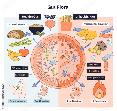 Gut flora doodle diagram contrasts healthy vs unhealthy microbiome, linking fiber foods to good digestion and sugar to dysbiosis, key objects, intestine, bacteria, foods. Doodle style diagram
