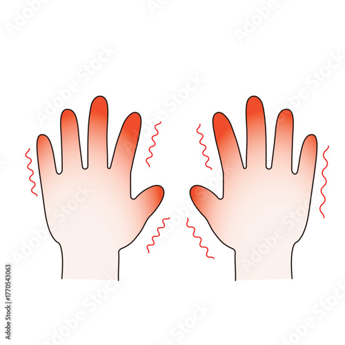 主線ありの寒さで赤くなった霜焼けの手のベクターイラスト