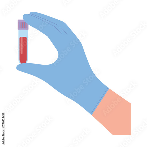 A gloved hand holds a test tube filled with red liquid, representing a medical sample.