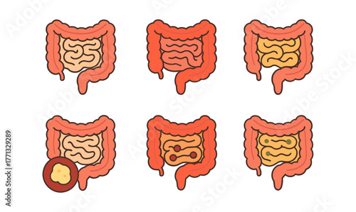 Colorful digestive issues: medical anatomy of intestines and symptoms with icons