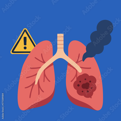 Lung cancer awareness, diagnosis and smoking risk vector illustration 22