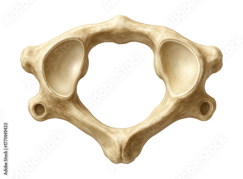 Atlas vertebra lacking a body, featuring large concave superior articular facets.