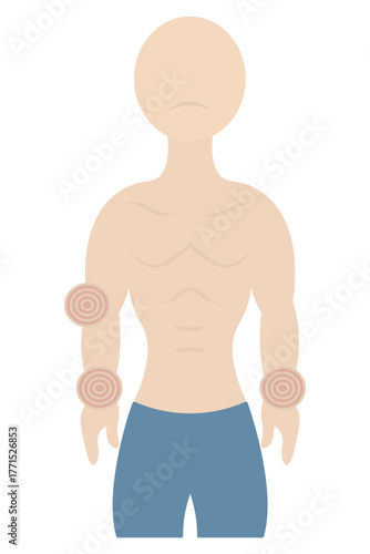 A patient with joint pain. The joints in his hands and elbows are sore. Color vector illustration. Muscular physique. Isolated on white background. Flat style. Medical theme. Web design idea.