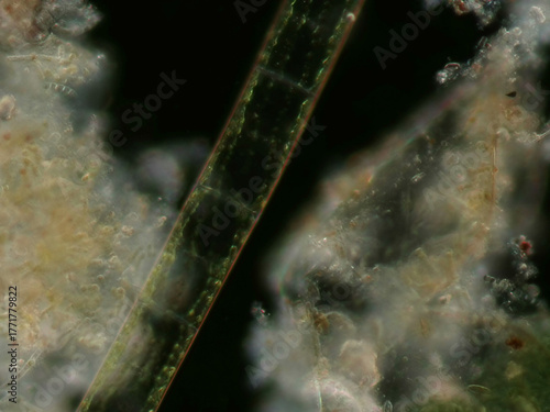 Tablou pe pânză Spirogyra sp